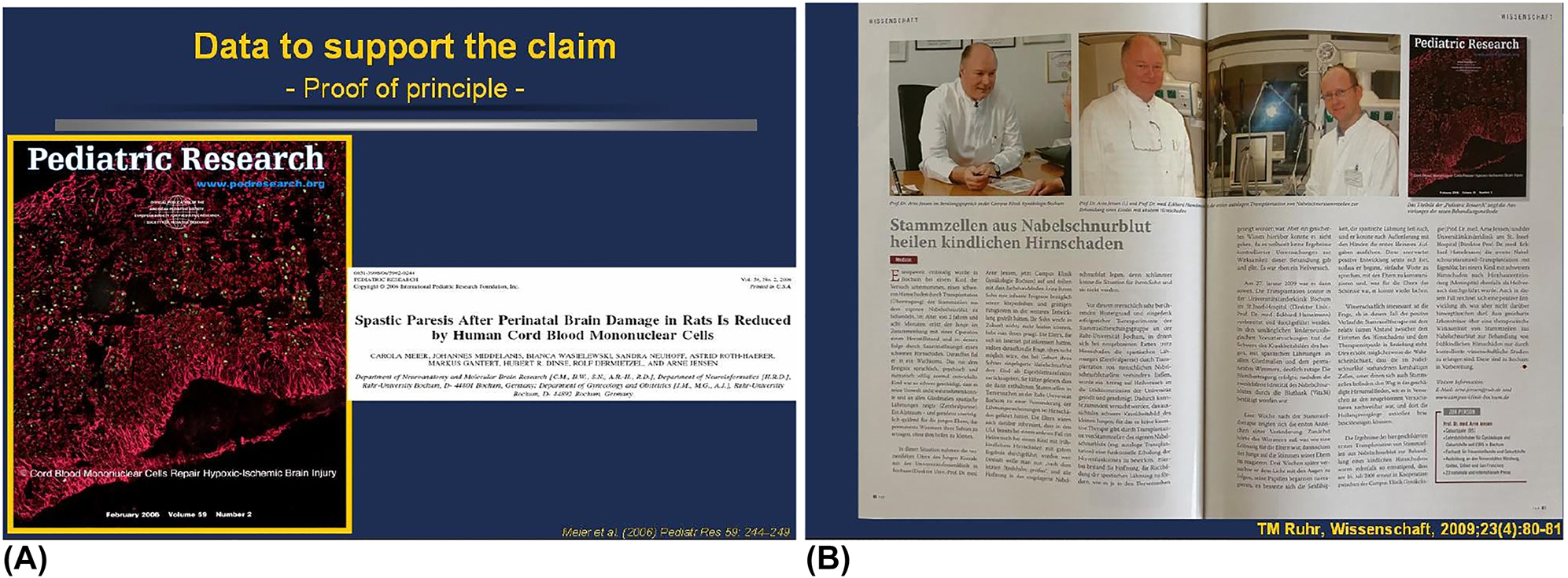 圖7：首次通過(guò)實(shí)驗和臨床證明臍帶血MNC可潛在治愈腦性癱瘓。