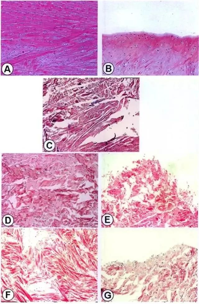 不同時(shí)間點(diǎn)修復組織紅-紅區與白-白區II型膠原表達量
