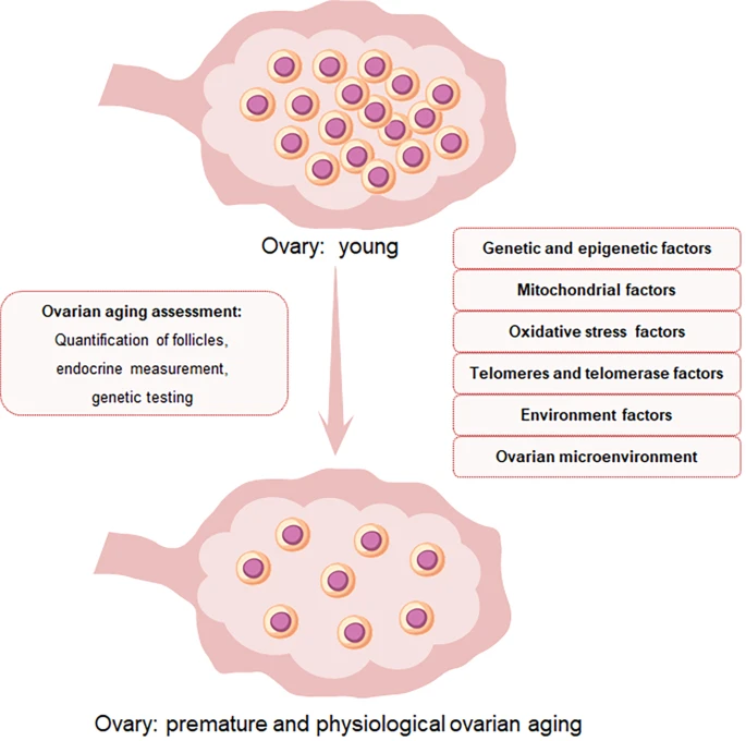 圖1：卵巢中卵泡數量和卵母細胞質(zhì)量與POI的關(guān)系示意圖
