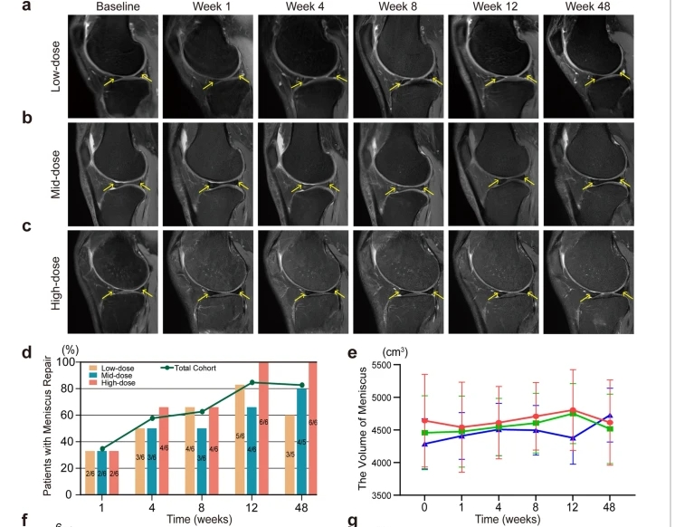 a – c不同劑量組膝關(guān)節 MRI 掃描中的半月板損傷。d半月板修復患者百分比。e注射后六個(gè)時(shí)間點(diǎn)的半月板體積分析。