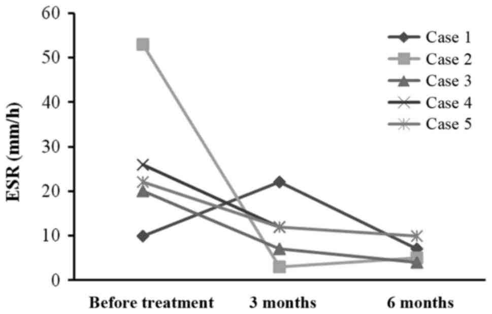每位患者治療前后的 ESR。3 位患者的 ESR 明顯下降。ESR，紅細胞沉降率。