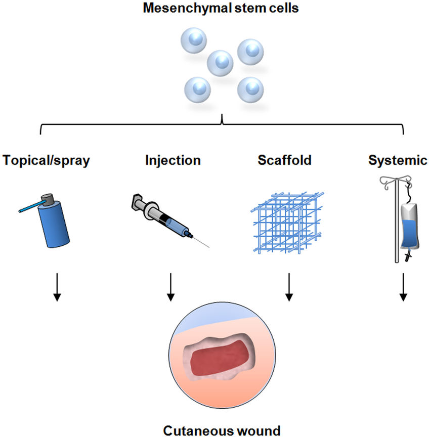 間充質(zhì)干細胞的治療方式有哪些—從傳統細胞移植到現代生物技術(shù)的應用