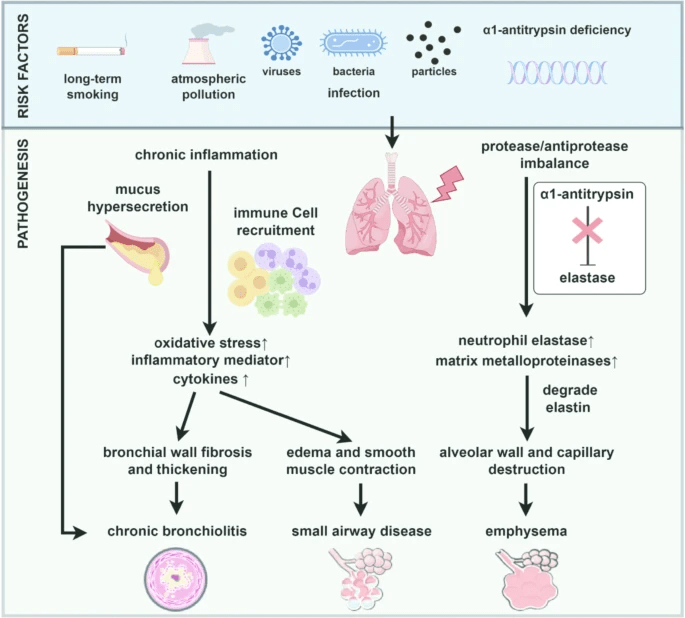 圖1：慢性阻塞性肺疾病的風(fēng)險因素和發(fā)病機制。