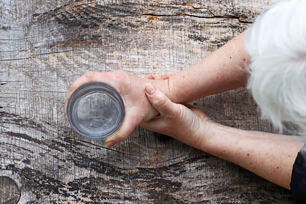 治療帕金森病的方案有那5大種？目前干細胞治療帕金森病前景如何？