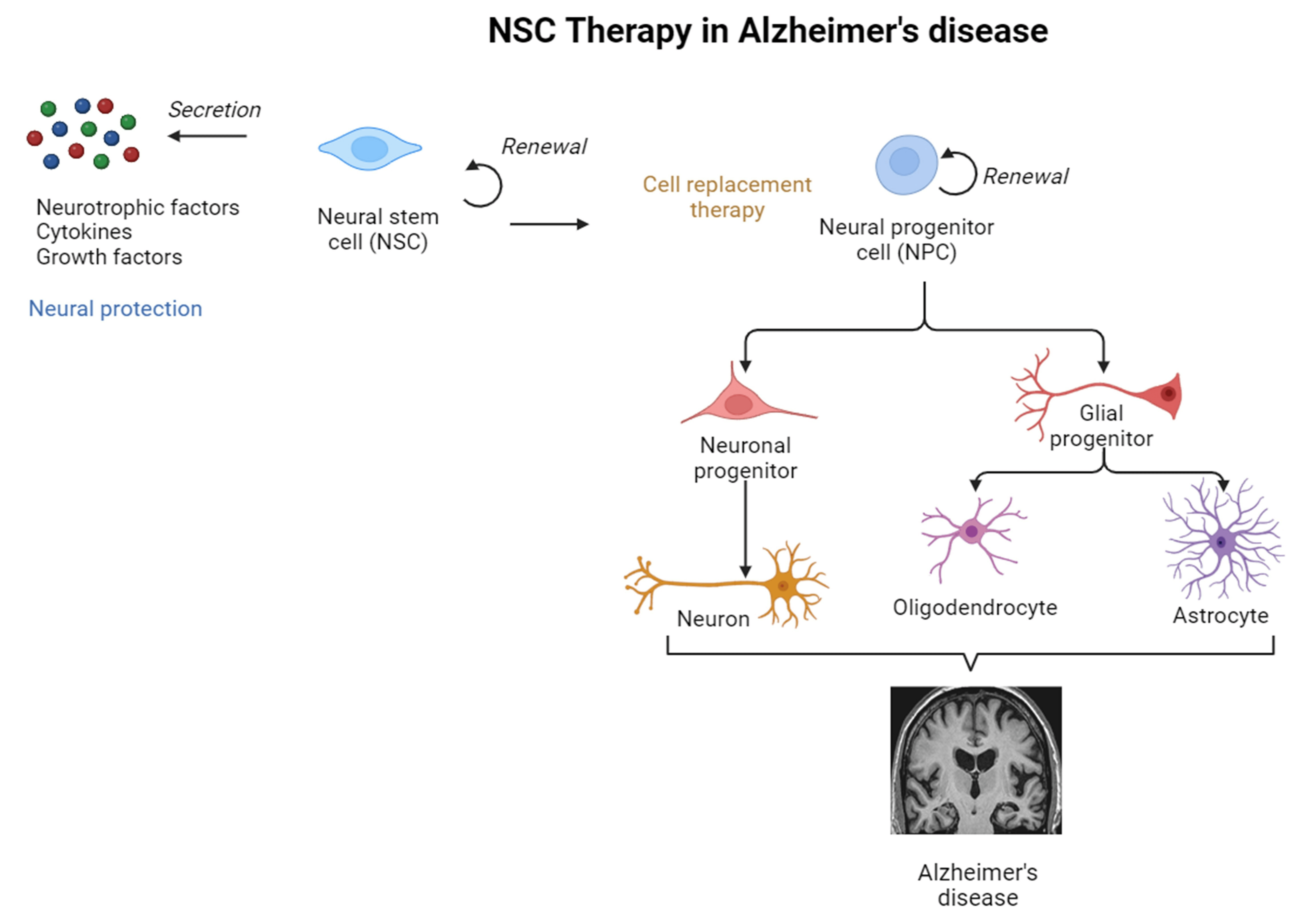 神經(jīng)干細胞移植治療阿爾茨海默病的圖解摘要