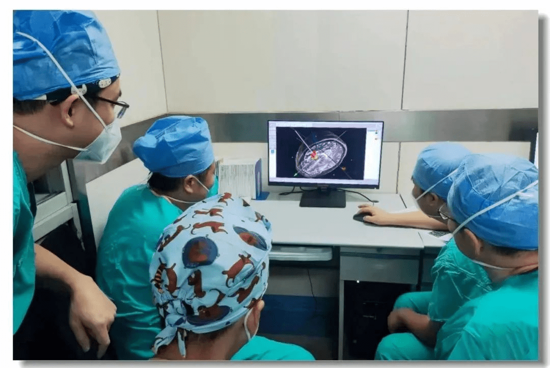 立體定向引導下神經(jīng)干細胞移植術(shù) 立體定向引導下神經(jīng)干細胞移植術(shù)