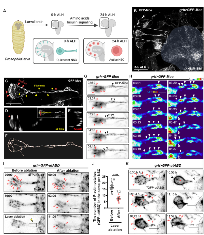 圖2:靜息態(tài)神經(jīng)干細胞再激活過(guò)程中的F-肌動(dòng)蛋白結構和動(dòng)力學(xué) 圖2:靜息態(tài)神經(jīng)干細胞再激活過(guò)程中的F-肌動(dòng)蛋白結構和動(dòng)力學(xué)
