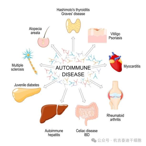 自身免疫性疾病的種類(lèi)