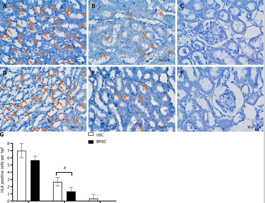 圖5：通過(guò)人類(lèi)白細胞抗原免疫染色檢測急性腎損傷小鼠腎臟內的尿液干細胞或骨髓間充質(zhì)干細胞