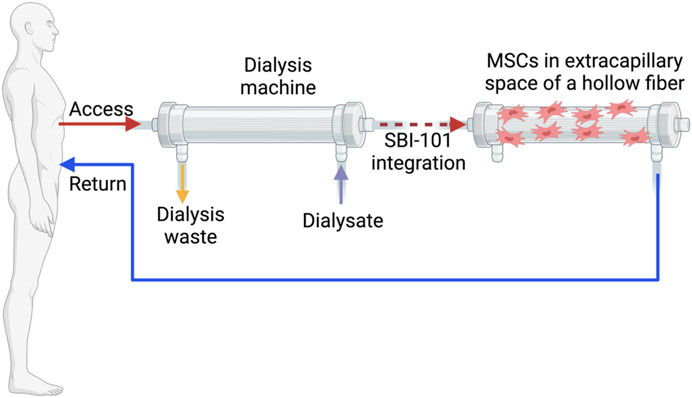 圖1：配備集成SBI-101系統的體外回路。