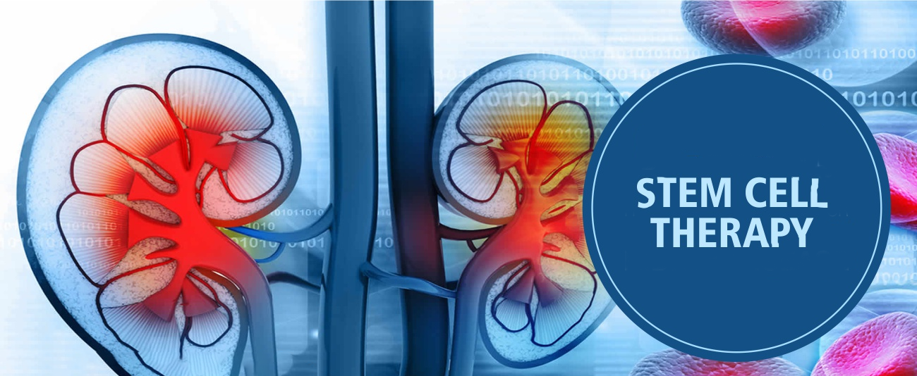 干細胞治療腎臟疾病的6大原理機制，您都了解嗎？