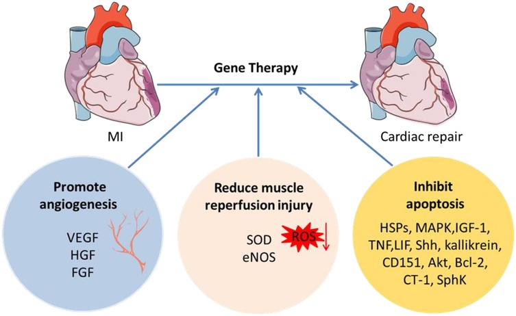 圖2：MI基因治療示意圖。