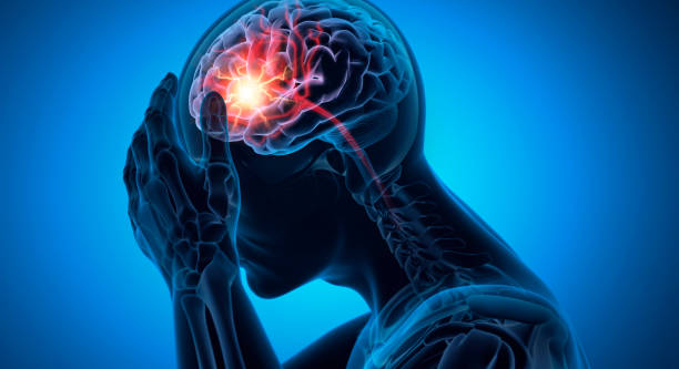 神經(jīng)干細胞移植：成為治療早期缺血性中風(fēng)時(shí)間窗困境的關(guān)鍵策略