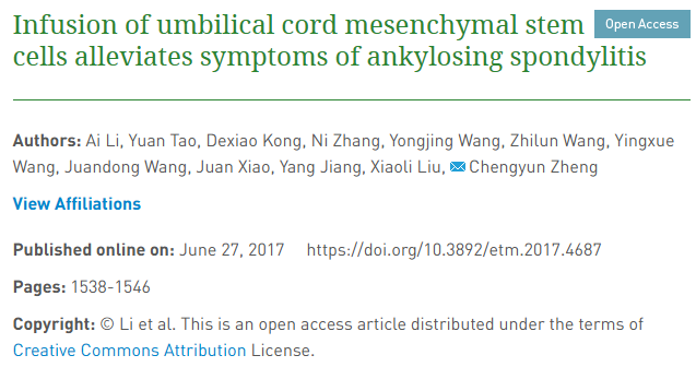 輸注臍帶間充質(zhì)干細胞可緩解強直性脊柱炎癥狀