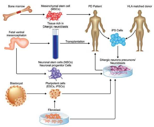 圖 (1)。不同類(lèi)型的干細胞可用于帕金森病的修復。