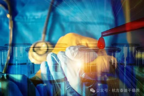 一名RA/MS患者經(jīng)過(guò)CAR-T治療失敗后，經(jīng)過(guò)自體干細胞移植后，主觀(guān)健康狀態(tài)顯著(zhù)改善！