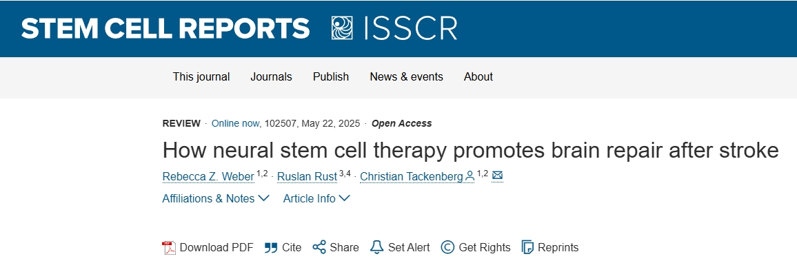 神經(jīng)干細胞療法如何促進(jìn)中風(fēng)后的大腦修復