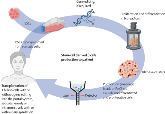 胚胎干細胞或誘導多能干細胞來(lái)源的β細胞的制備和移植