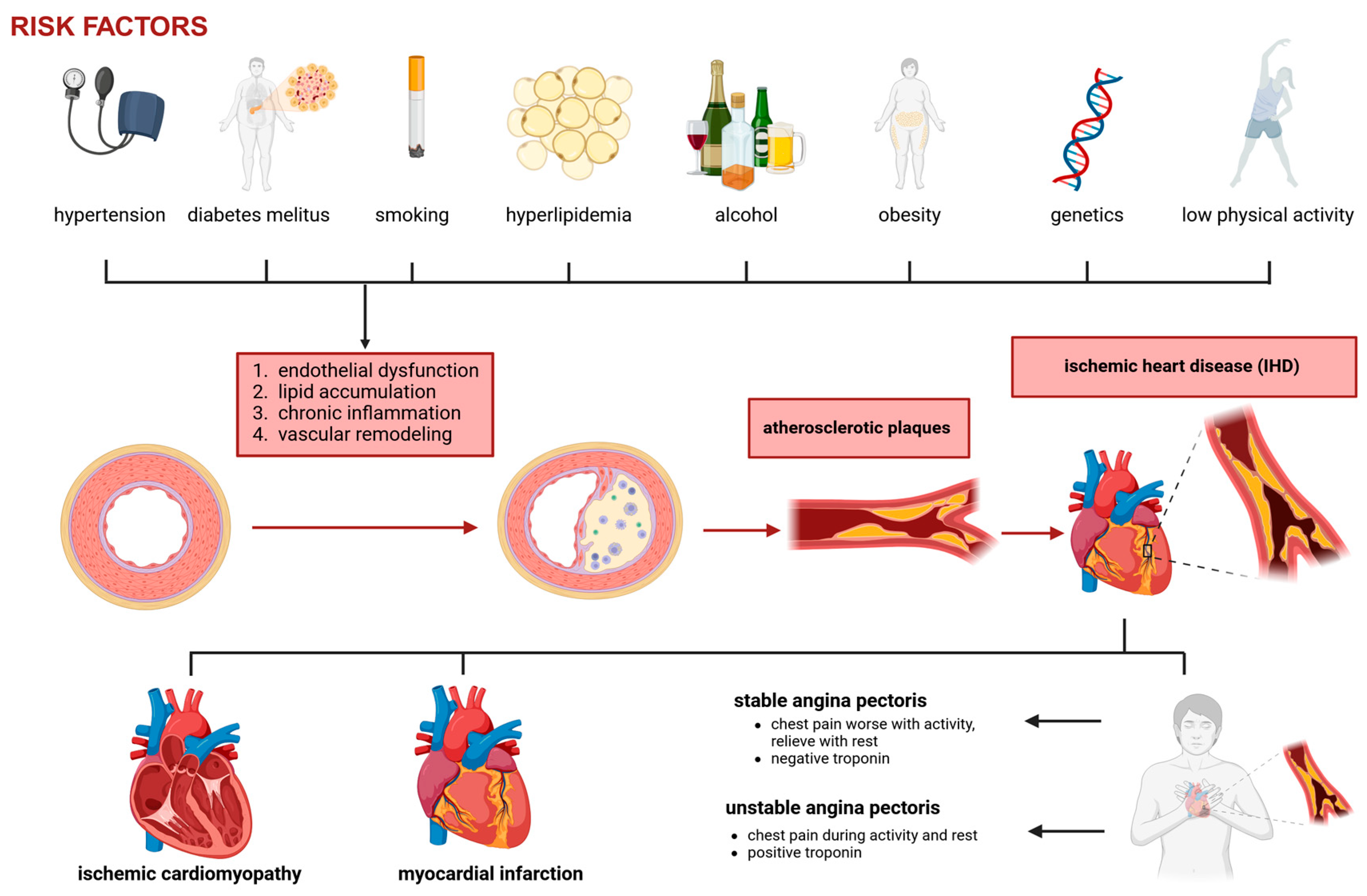 圖1：冠狀動(dòng)脈疾病和缺血性心臟病的病理生理學(xué)。
