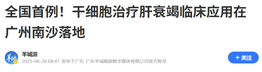 全國首例異體骨髓間充質(zhì)干細胞（MSC）治療慢加急性肝衰竭