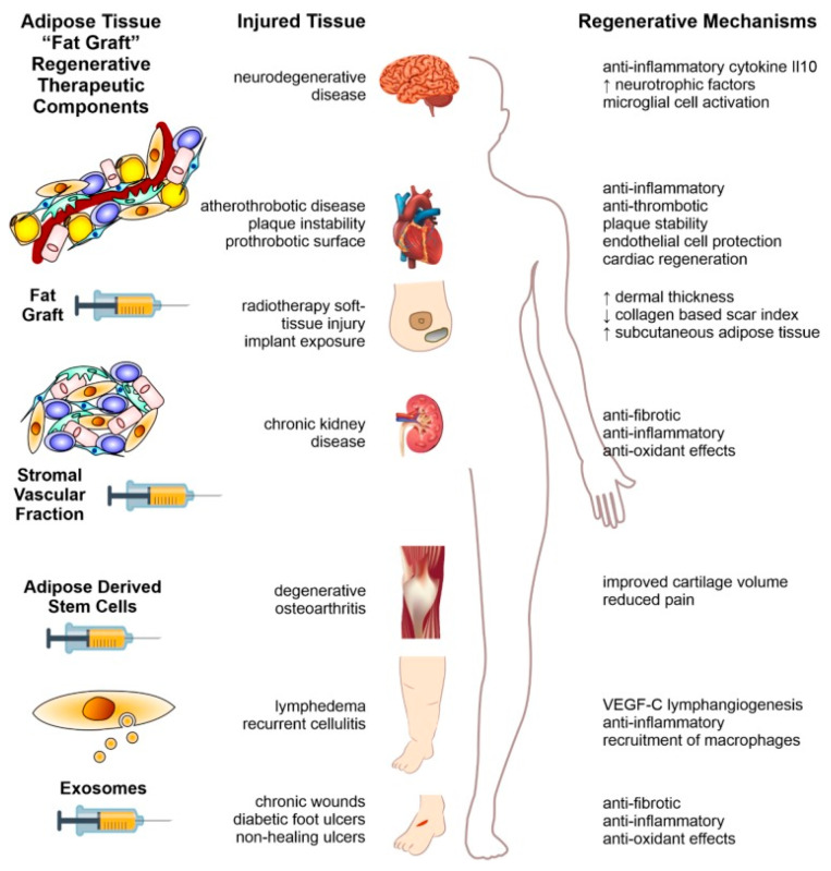 圖2：本文以示意圖形式概述了利用脂肪組織脂肪治療人類(lèi)疾病的方法。
