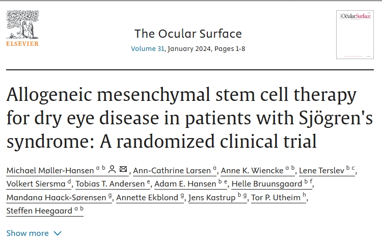 異基因間充質(zhì)干細胞治療干燥綜合征患者干眼癥：一項隨機臨床試驗