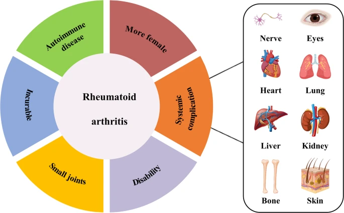 圖1：類(lèi)風(fēng)濕性關(guān)節炎的一般特征。