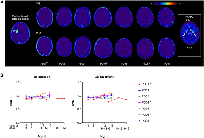 圖2：移植對象和對照對象的[18F]GE180PET掃描結果