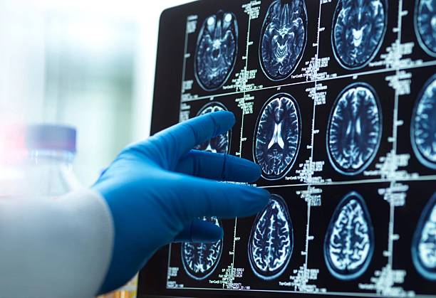 神經(jīng)干細胞移植十大常見(jiàn)問(wèn)題解答：從原理到術(shù)后護理全知道