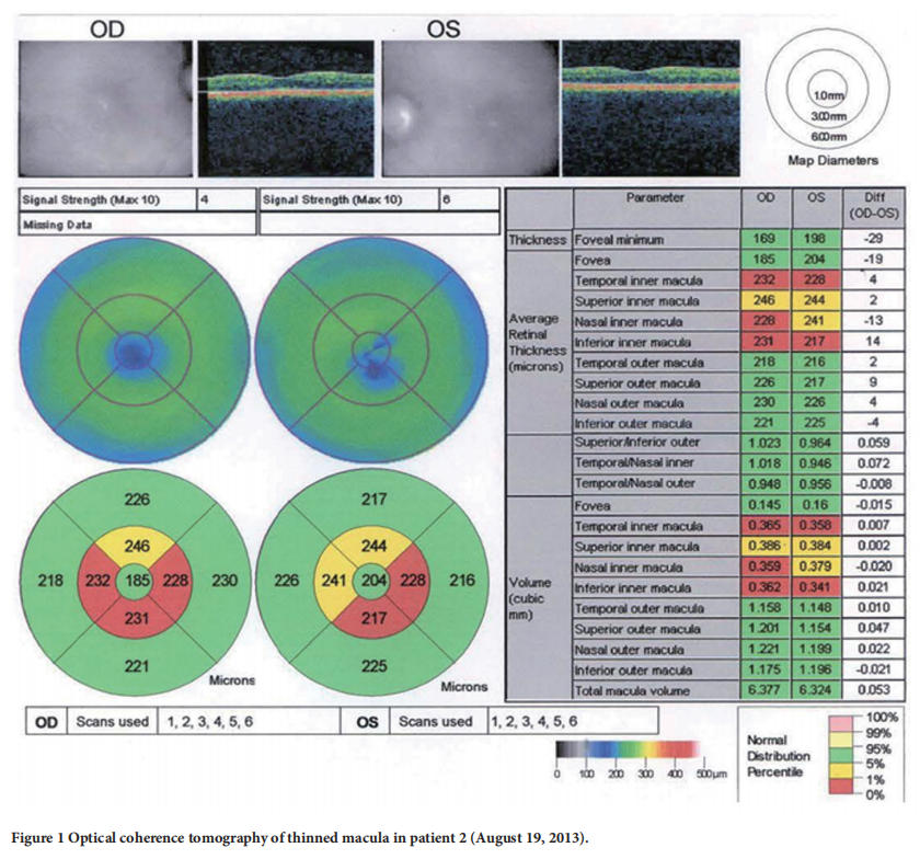 遺傳性視神經(jīng)病變臨床試驗