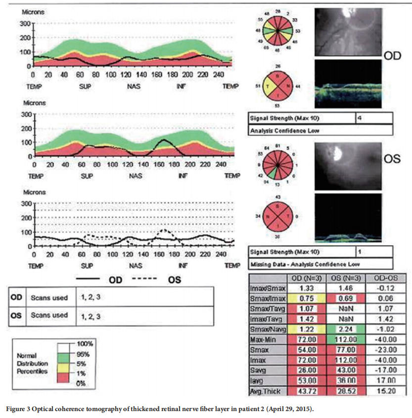 遺傳性視神經(jīng)病變臨床試驗