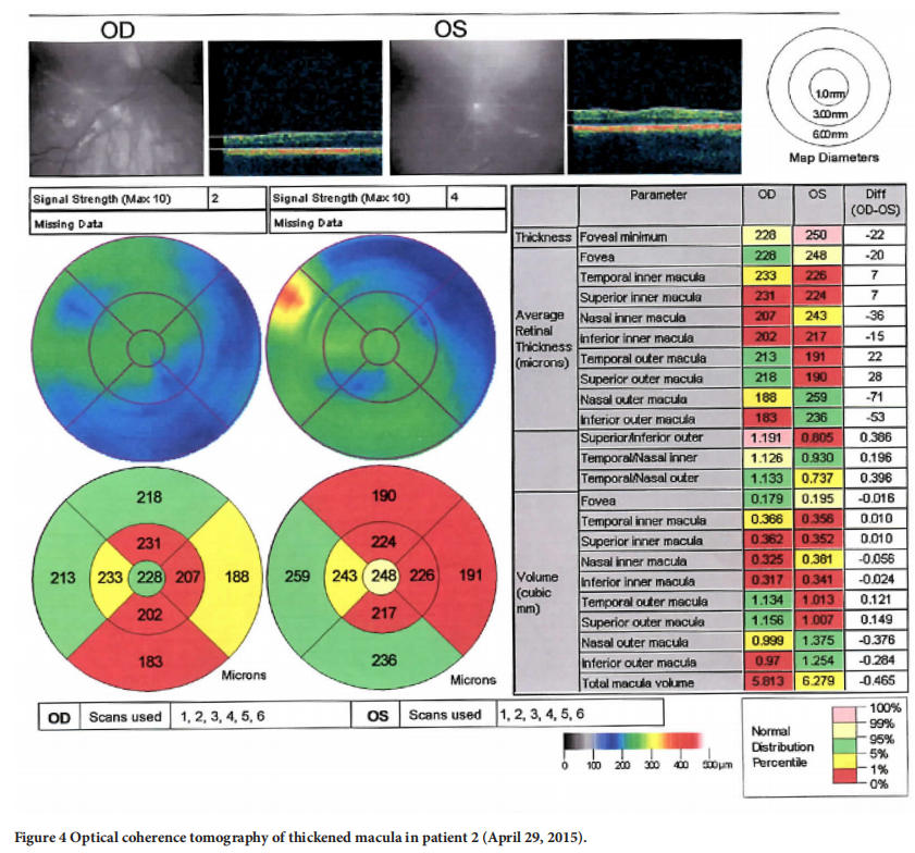 遺傳性視神經(jīng)病變臨床試驗