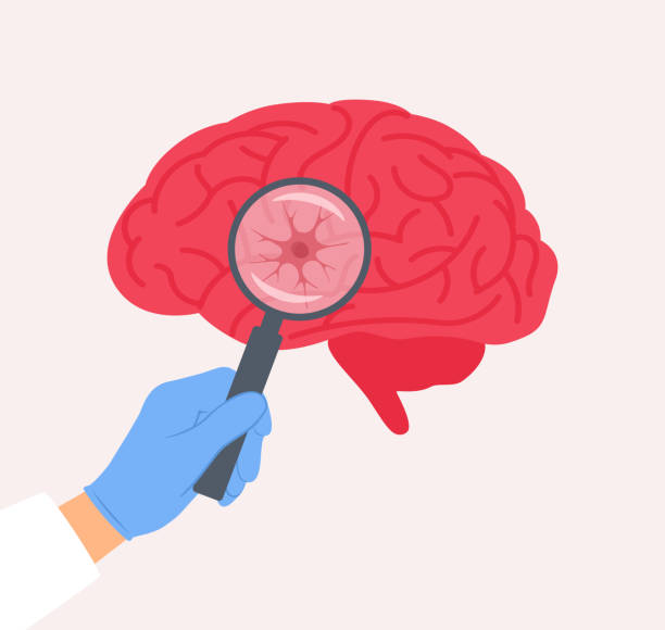 干細胞療法vs深部腦刺激：帕金森病進(jìn)階治療方案療效對比