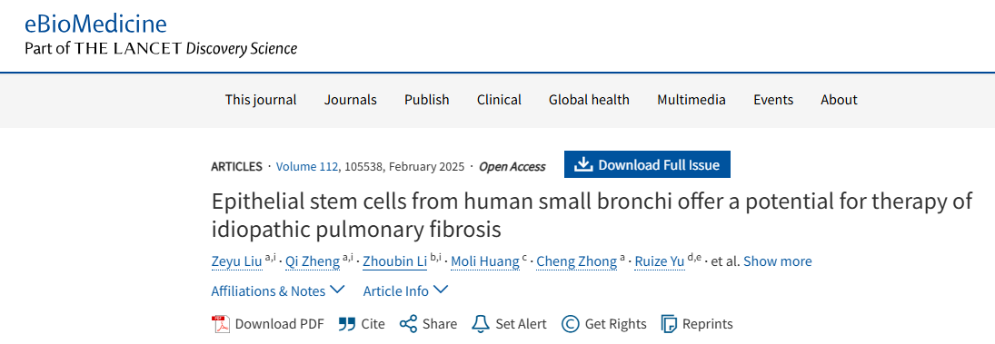 人類(lèi)小支氣管上皮干細胞為治療特發(fā)性肺纖維化提供了潛力