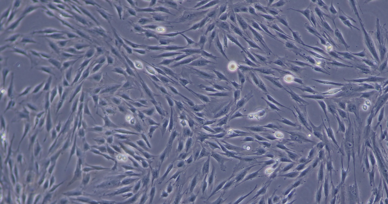 間充質(zhì)干細胞