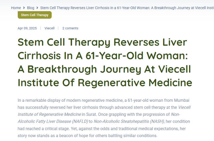 干細胞療法逆轉61歲女性肝硬化：Viecell再生醫學(xué)研究所的突破之旅