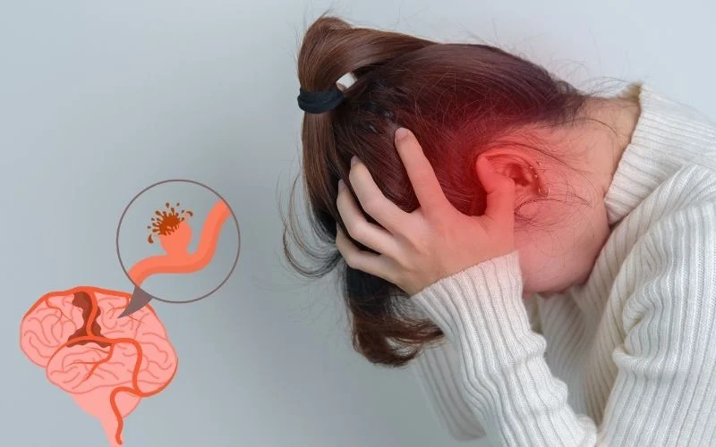 神經(jīng)干細胞移植治療腦出血：機制、療效與轉化前景