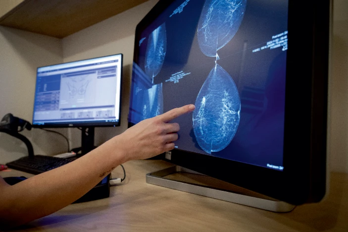 轉移性乳腺癌患者迫切需要新的治療方法。