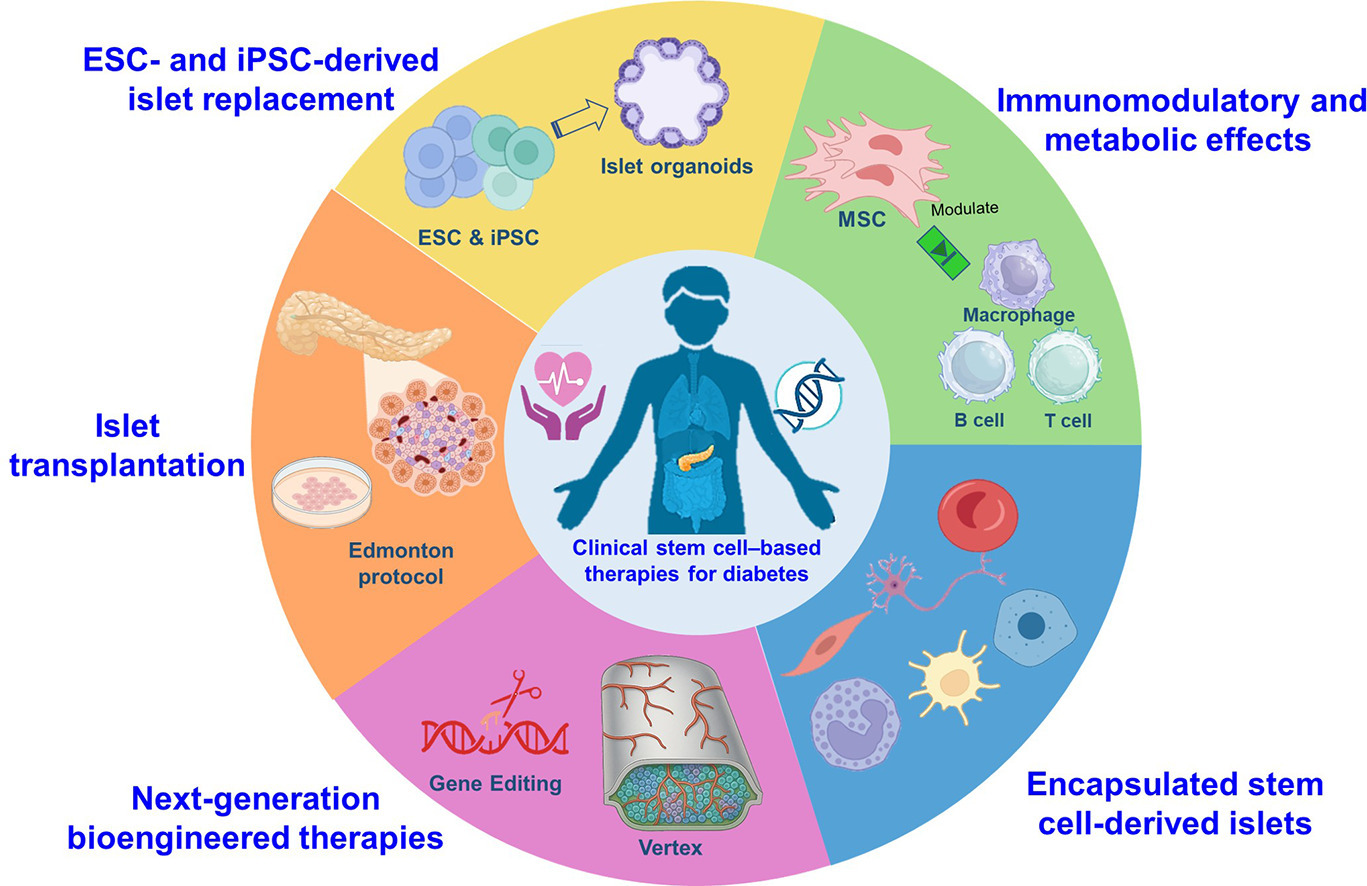 干細胞療法重塑糖尿病治療格局——主要臨床試驗概述與未來(lái)展望